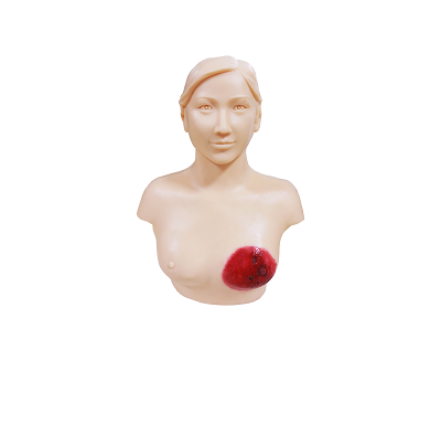 高级乳痈诊断训练模型.png