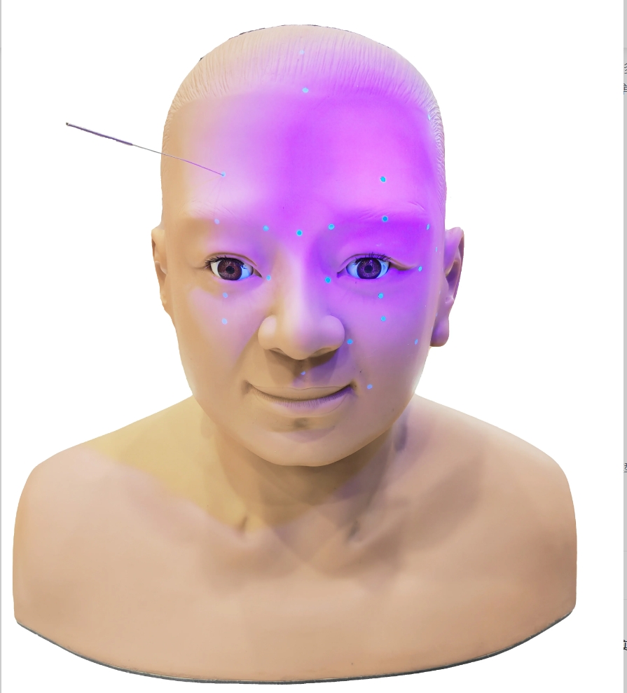 1770443225144085.png 头部针灸1.png